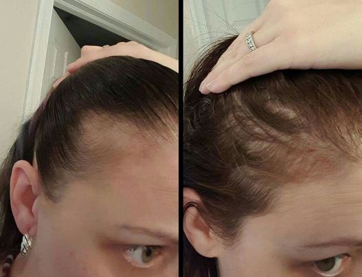 Before & After